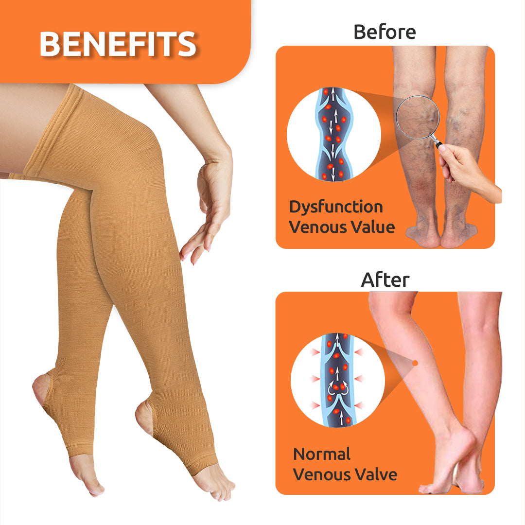 Vissco Varicose Vein Stockings | Provides Leg Compression to Improve Blood Circulation & Relieves Pain (Beige)