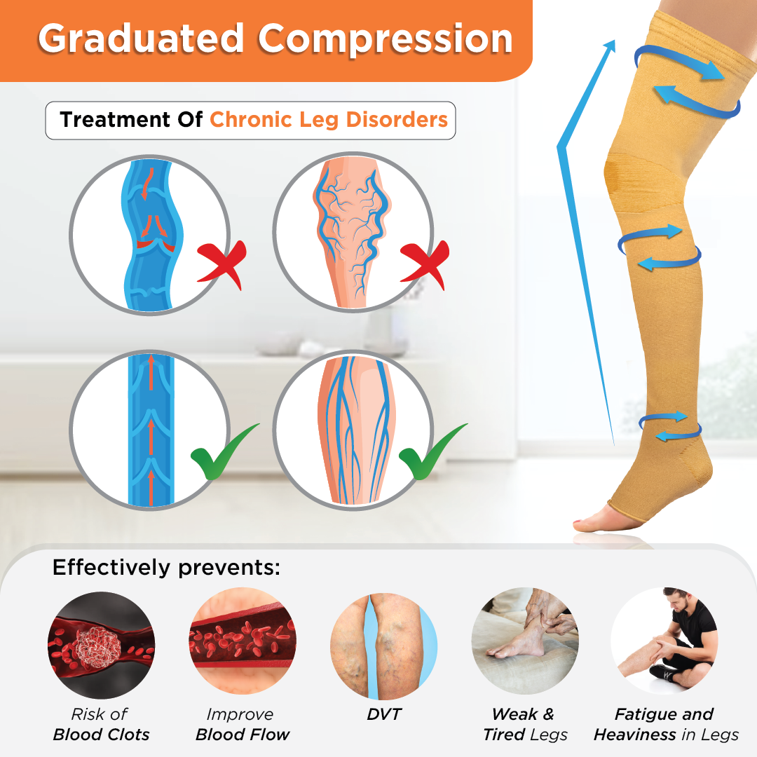 Vissco Medical Compression Stockings (Above Knee) | Improves Blood Circulation & Relieves Pain (Beige)