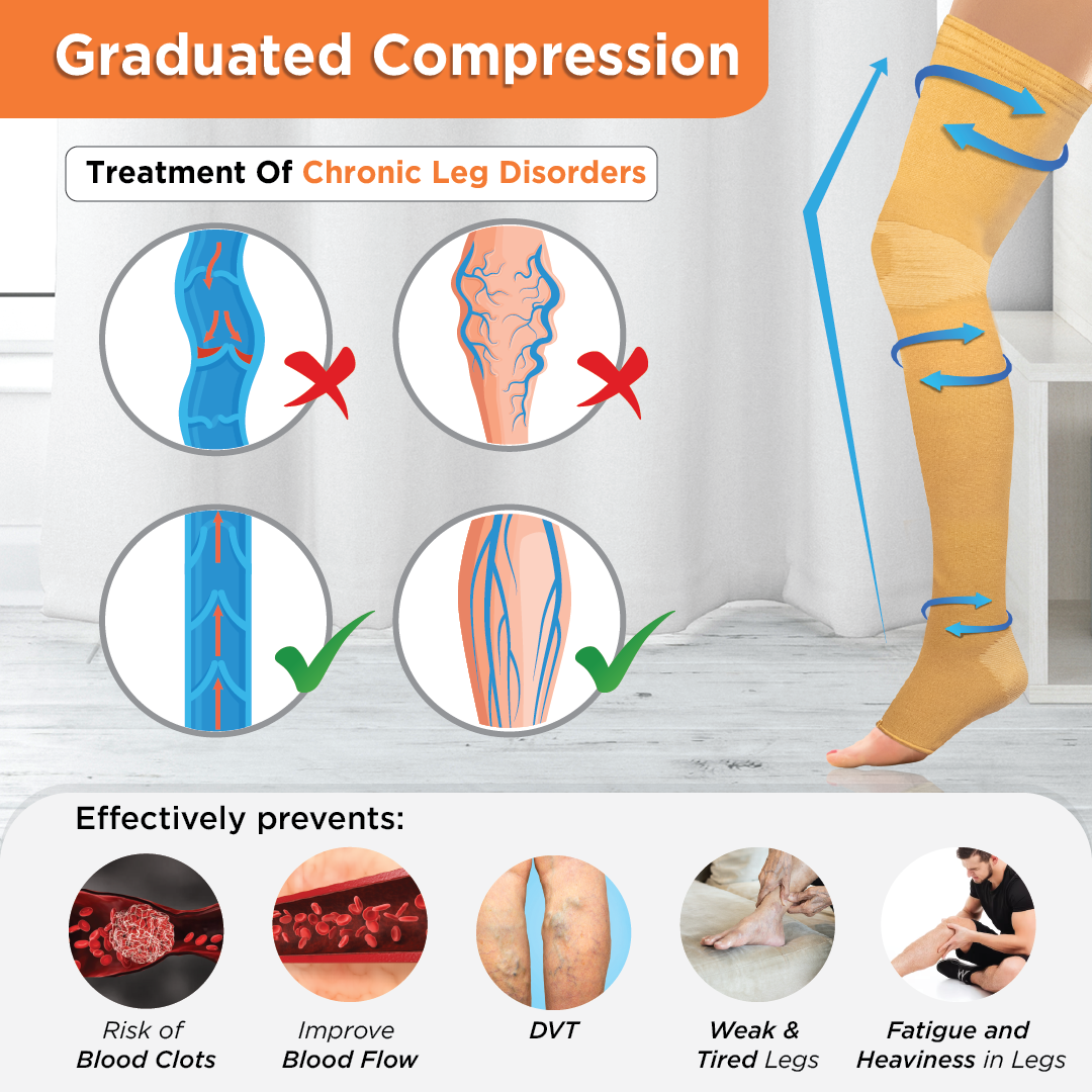 Vissco Anti Embolism Stocking (Mild Support) | Improves Blood Circulation |  Swollen | Tired | Aching Legs (Beige)