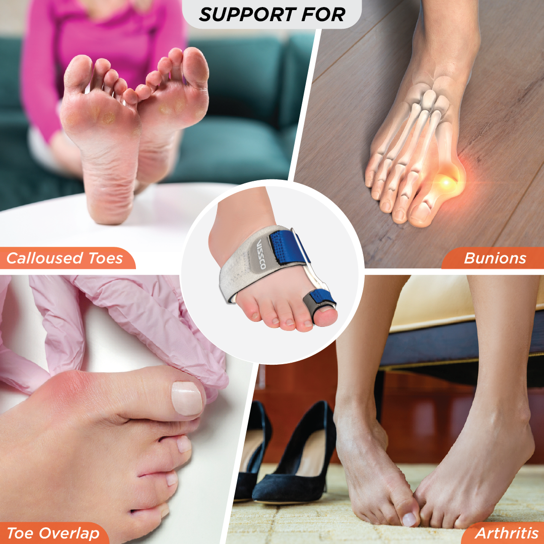 Vissco Bunion Corrector | Provides Moderate Support to Big Toe | Fracture Support & to Correct Bunion Deformity