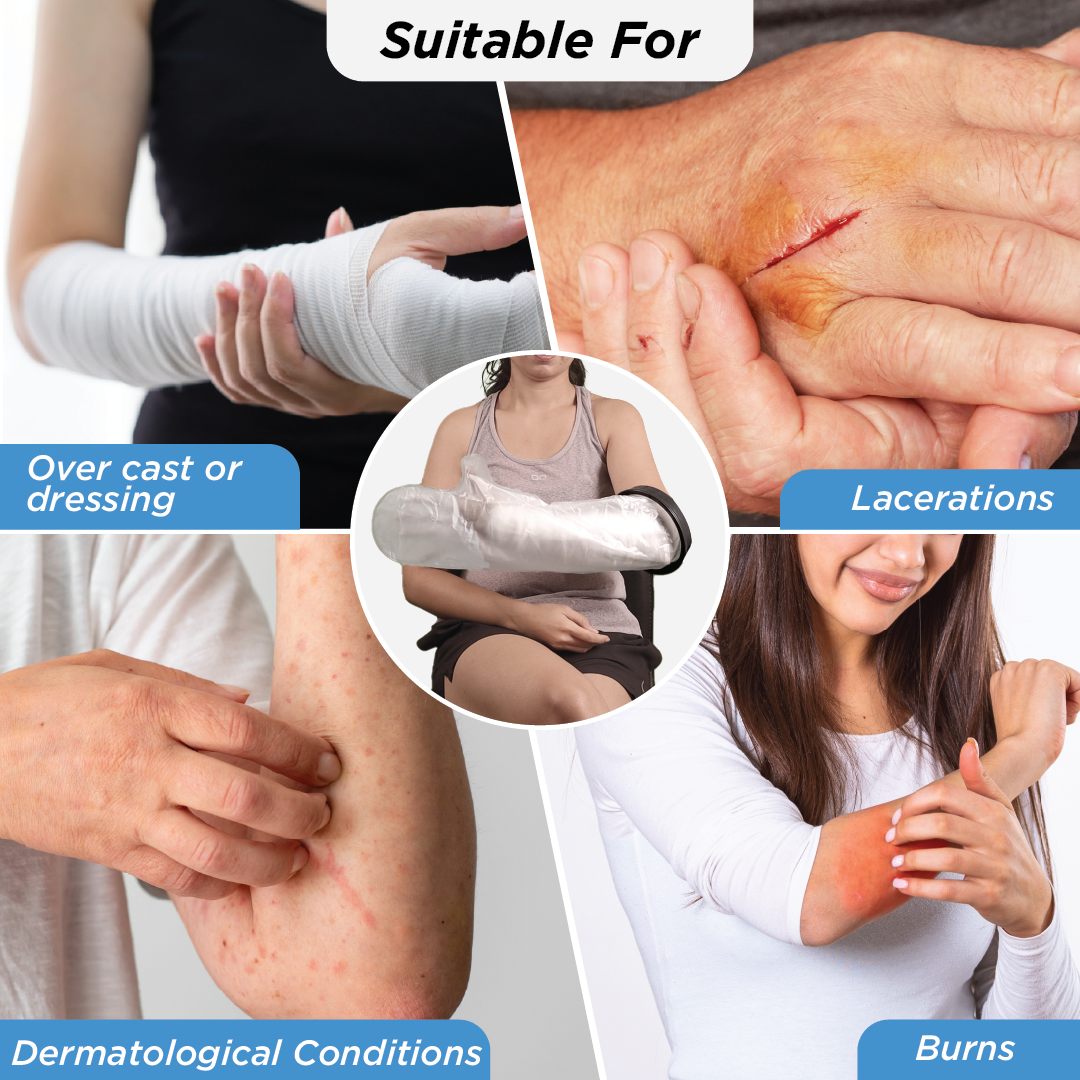 Vissco Cast Cover for Left & Right Hand Upto Elbow | Protects Bandage from Water Exposure during Bath & Shower (Grey)