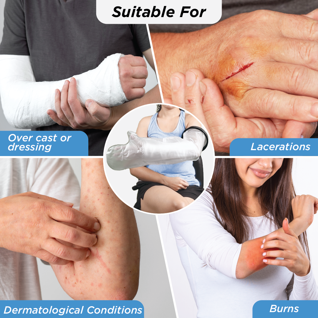 Vissco Cast Cover for Left & Right Hand Upto Upper Arm | Protects Bandage from Water Exposure during Bath & Shower (Grey)
