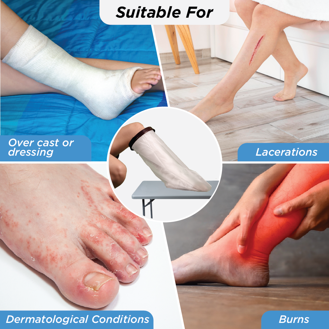 Vissco Cast Cover - Leg Upto Knee | Cast Cover for Left & Right Leg (1 Piece) | Protects Bandage From Water Exposure during Bath & Shower (Grey)