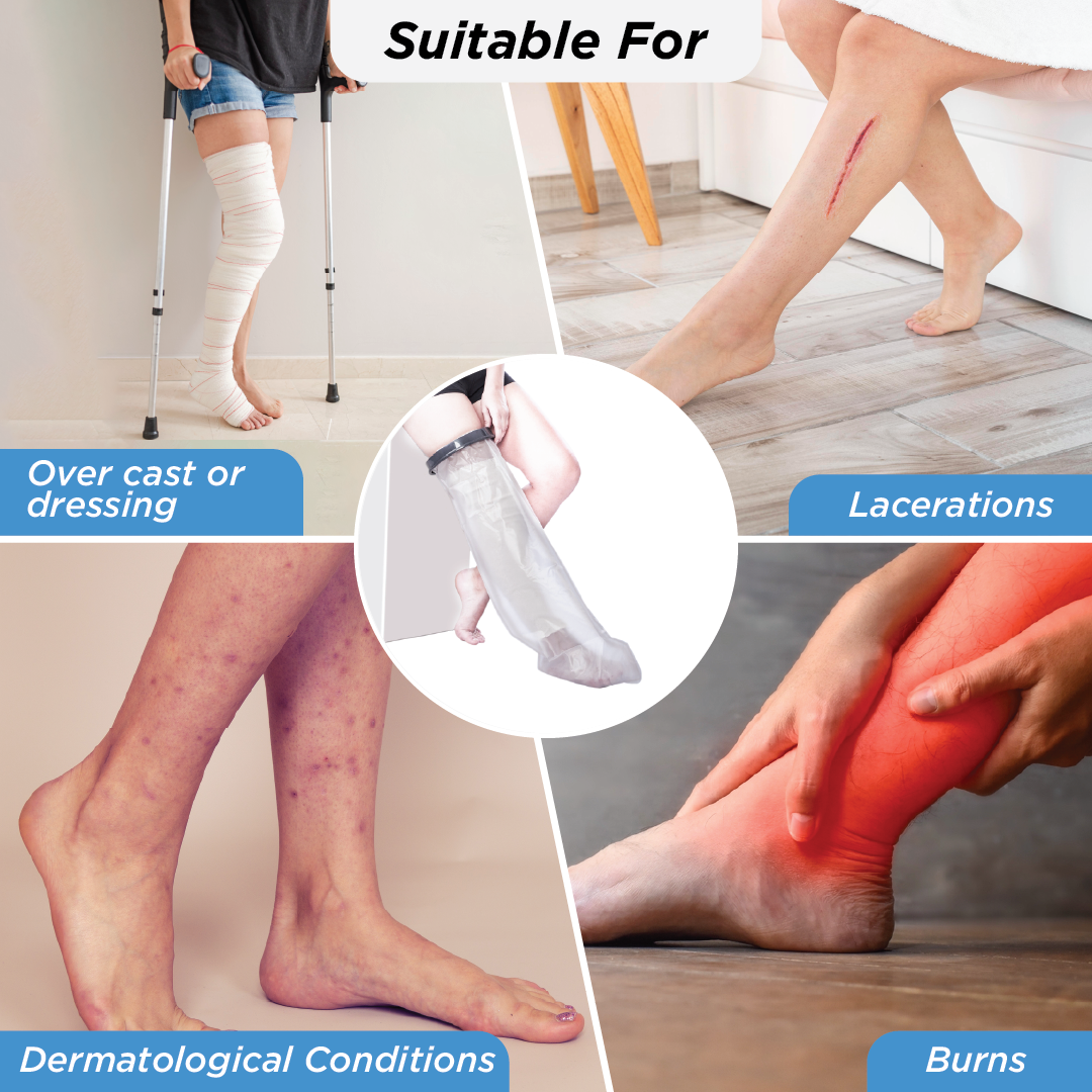 Vissco Cast Cover - Leg Upto Thigh | Cast Cover for Left & Right Leg (1 Piece) | Protects Bandage From Water Exposure during Bath & Shower (Grey)