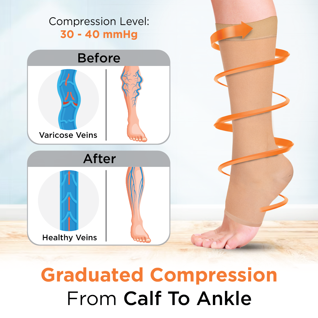 Vissco Medical Compression Stocking - Class 2 Knee Length | Mild Support | Improves Blood Circulation | Swollen | Tired | Aching Legs  (Beige)