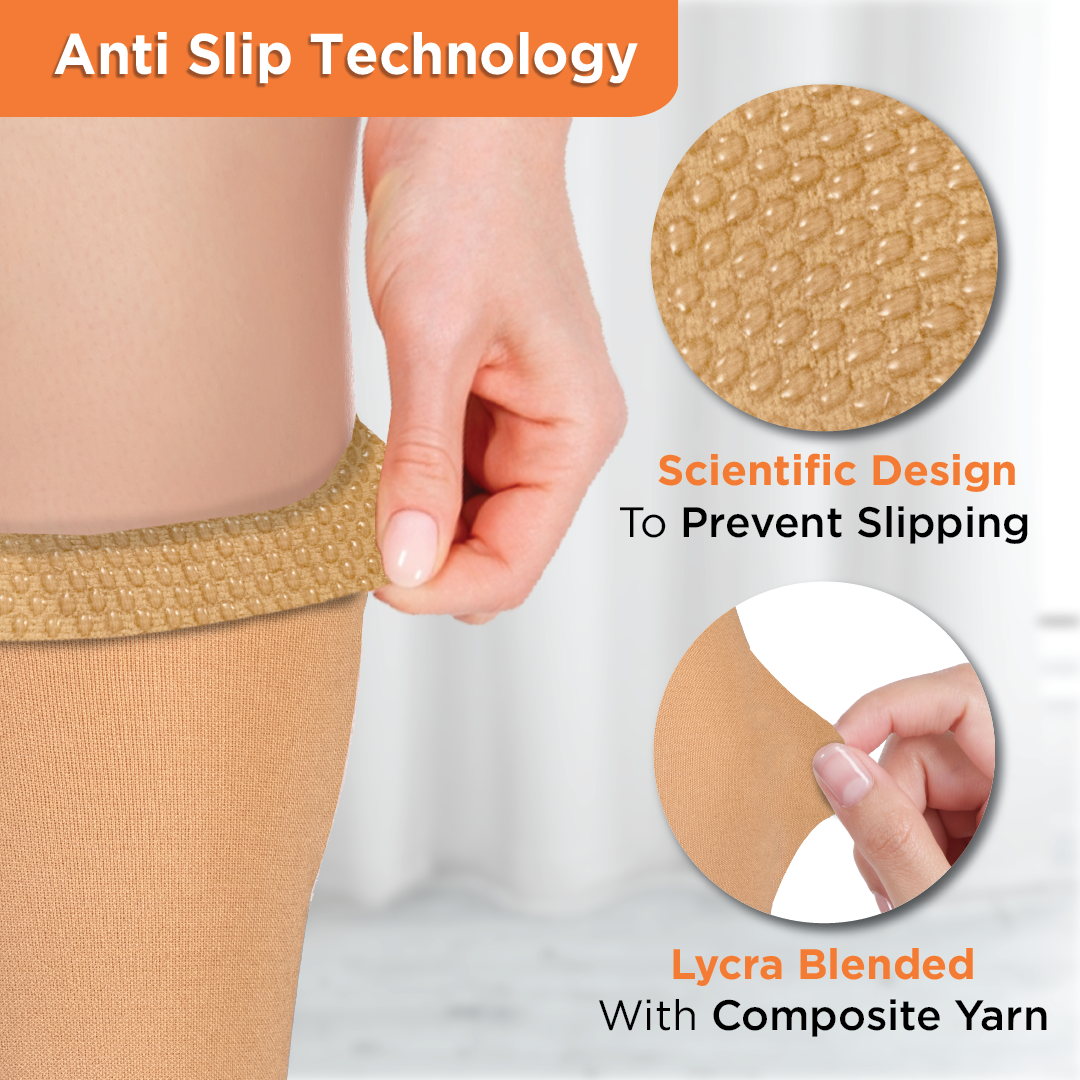 Vissco Medical Compression - Class 2 Thigh Length|Mild Support | Improves Blood Circulation | Swollen | Tired | Aching Legs  (Beige)