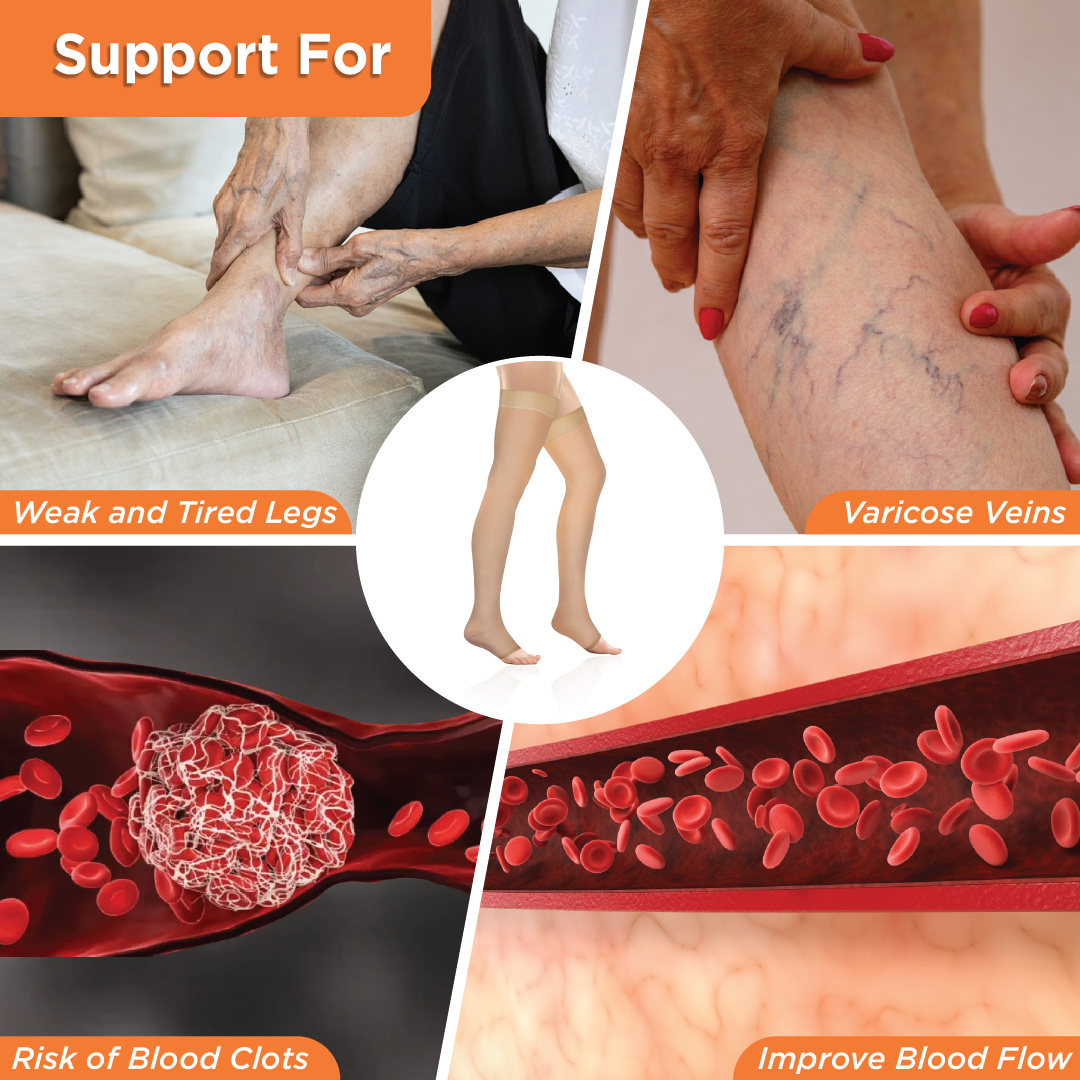 Vissco Medical Compression - Class 2 Thigh Length|Mild Support | Improves Blood Circulation | Swollen | Tired | Aching Legs  (Beige)