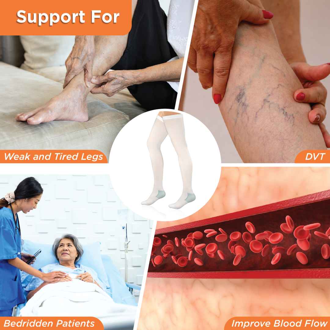 Vissco Anti-Embolism - Thigh (Lower Inspection Hole) | Mild Support | Improves Blood Circulation | Put it on for Swollen, Tired, Aching Legs (White)