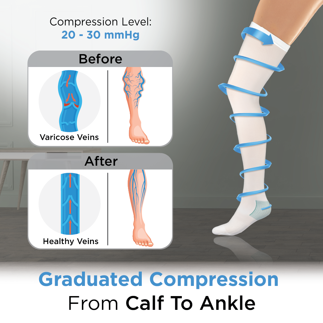 Vissco Anti-Embolism Stocking (13-18 mmHg) - Thigh Length | Closed Toe with Lower Inspection Hole