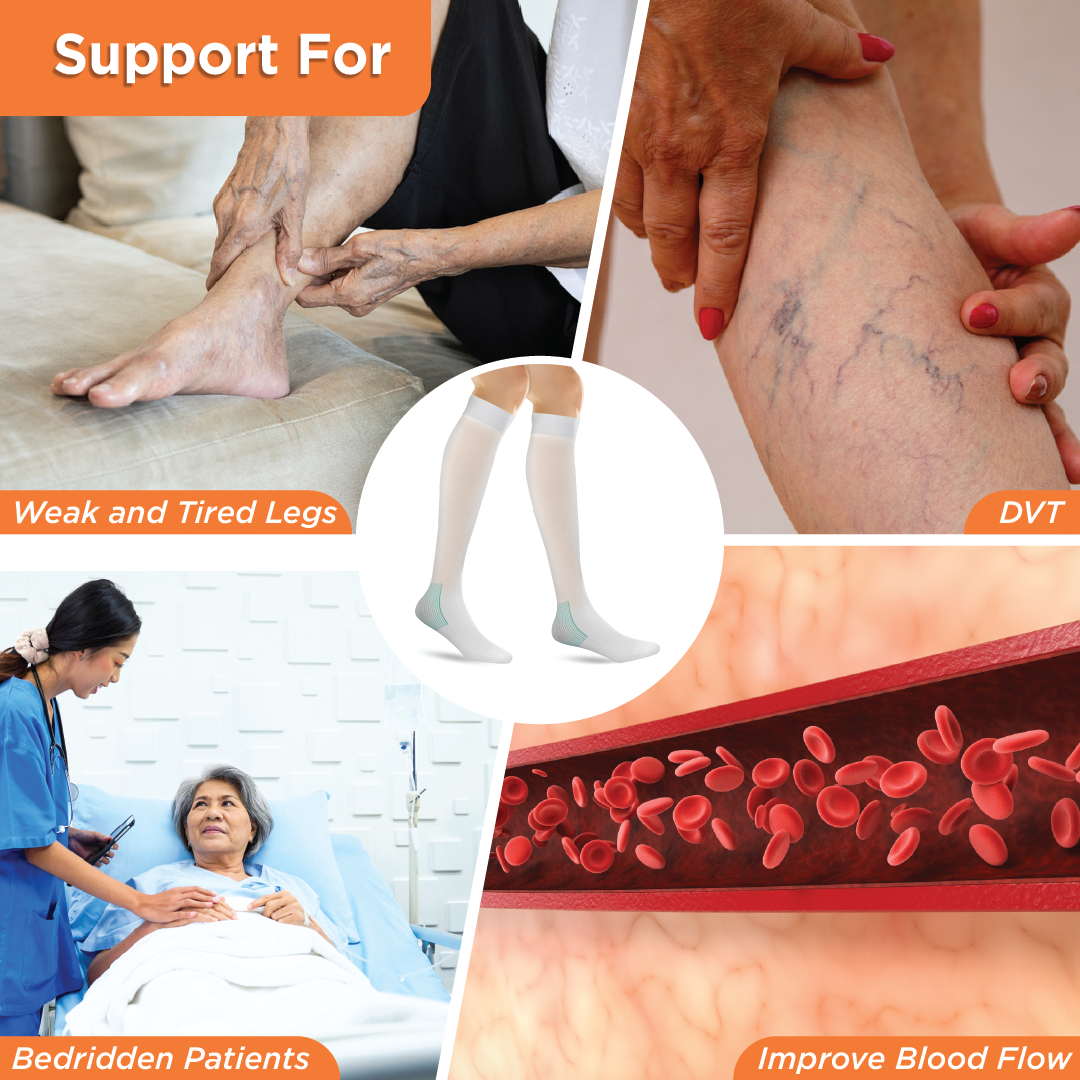Vissco Anti-Embolism - Knee (Lower Inspection Hole) | Mild Support | Improves Blood Circulation | Put it on for Swollen, Tired, Aching Legs (White)