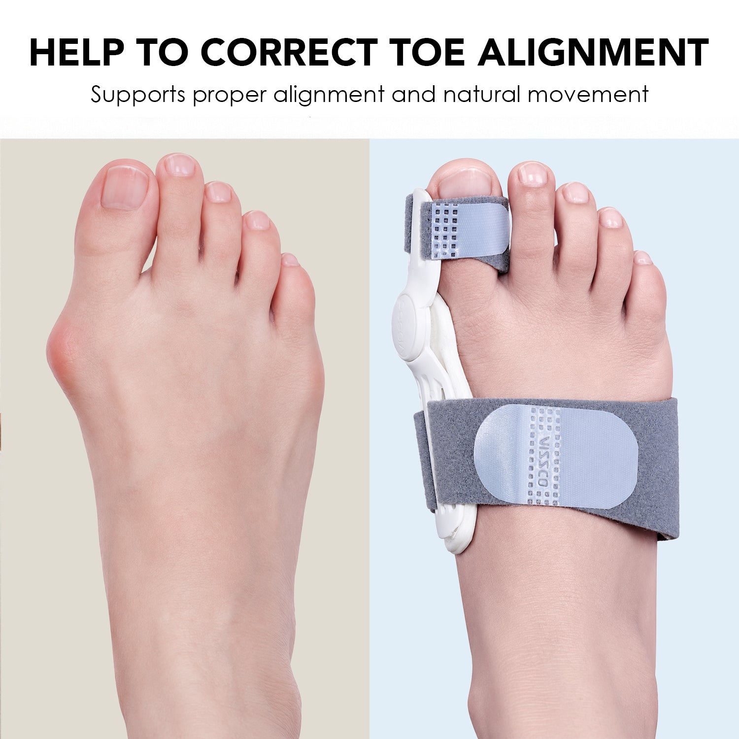 Vissco Bunion Corrector